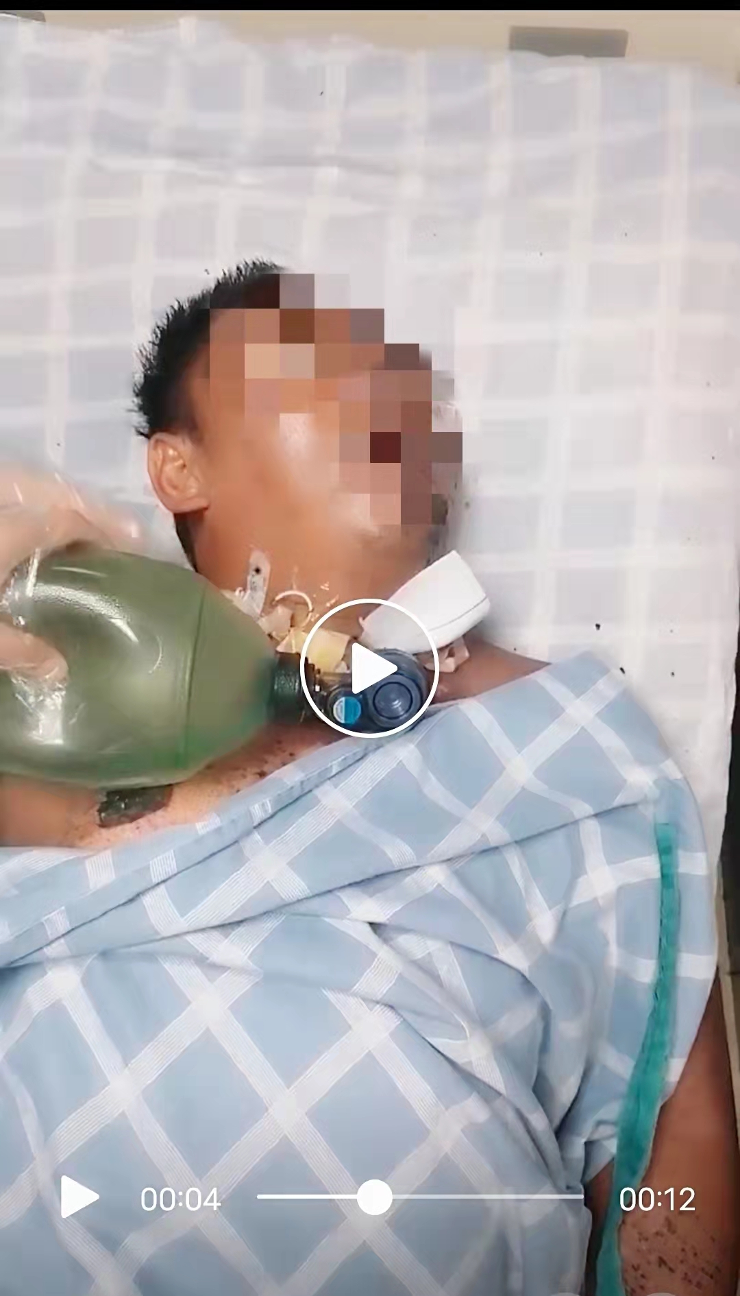 患者入院治療1.jpg 患者入院治療1.jpg